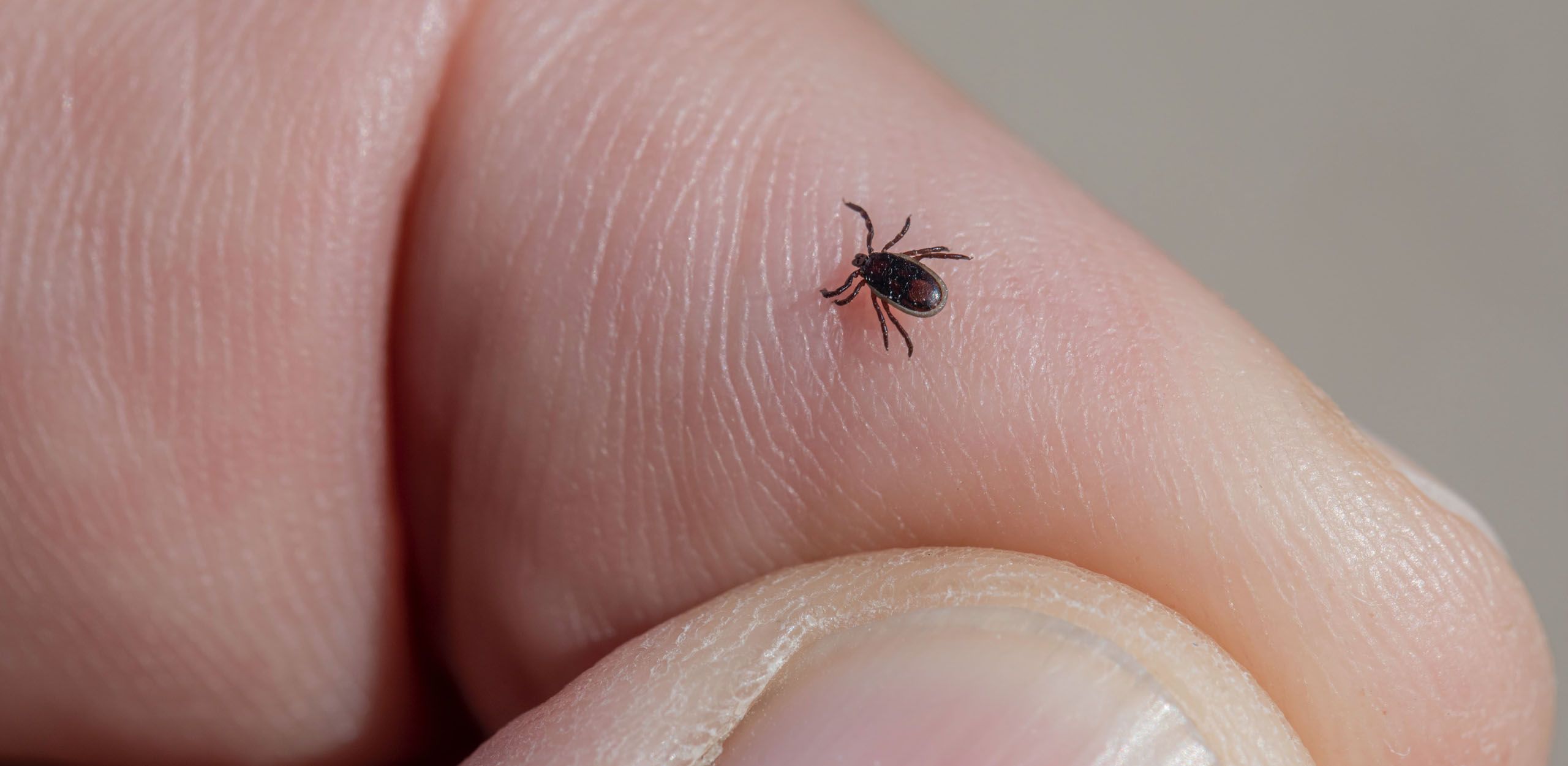 Overcoming Lyme Disease with Essential Oils - Volume 10, Number 3