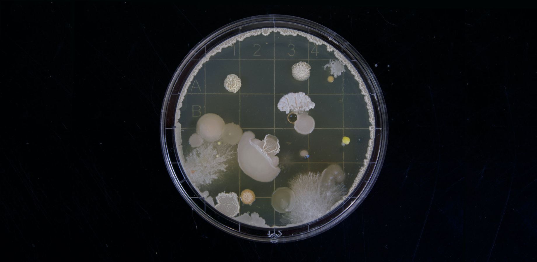 Are Essential Oils a Cure for Monster Bacteria like MRSA? - Volume 8, Number 1